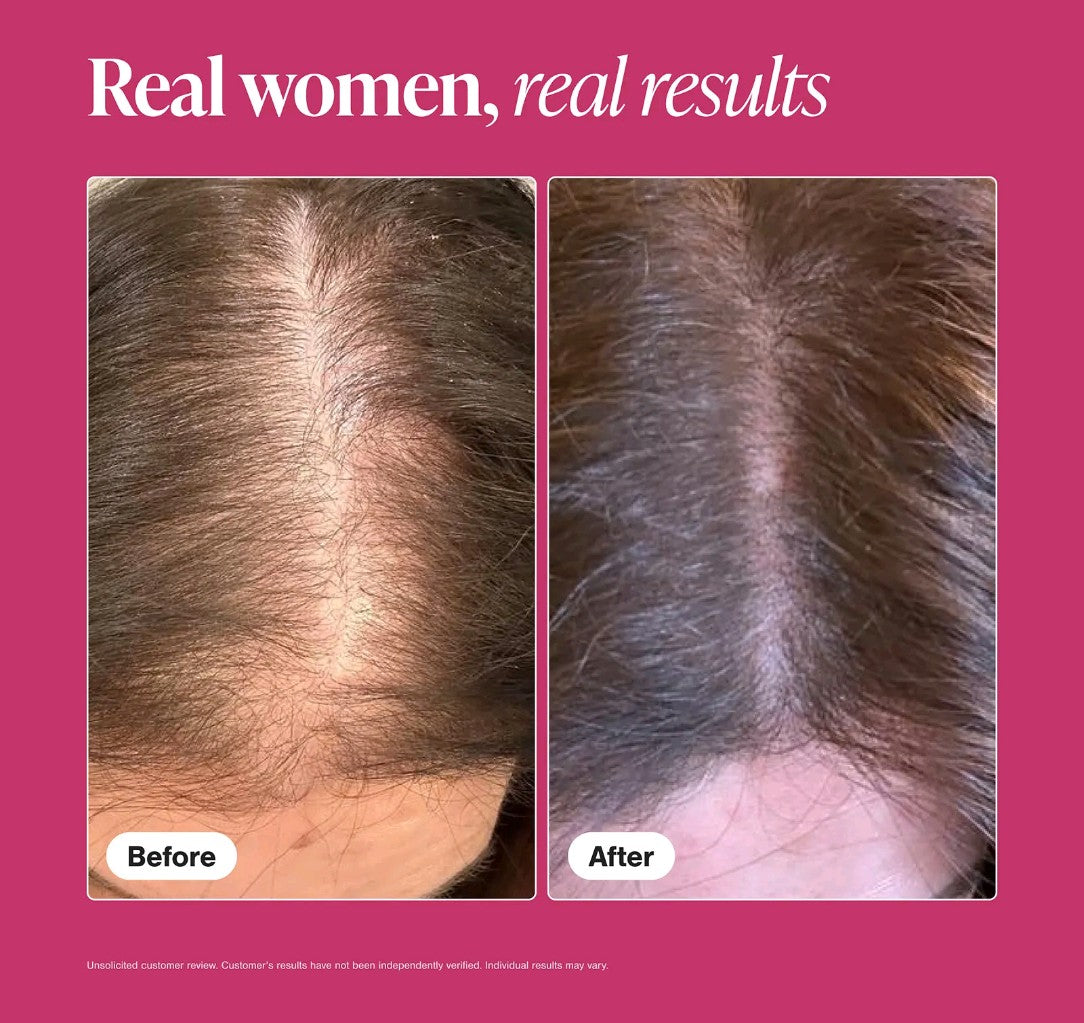 Viviscal-Hair growth